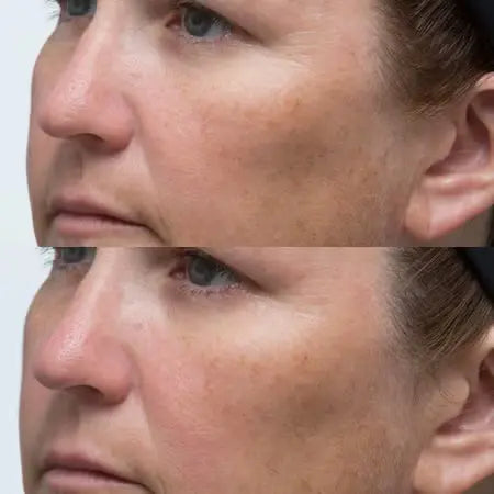 Primer plano muestra el antes y después de usar Perrione High Potency Classics Hyaluronic Intensive Moisturizer.