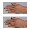 Cold Plasma Plus+ Hand Therapy