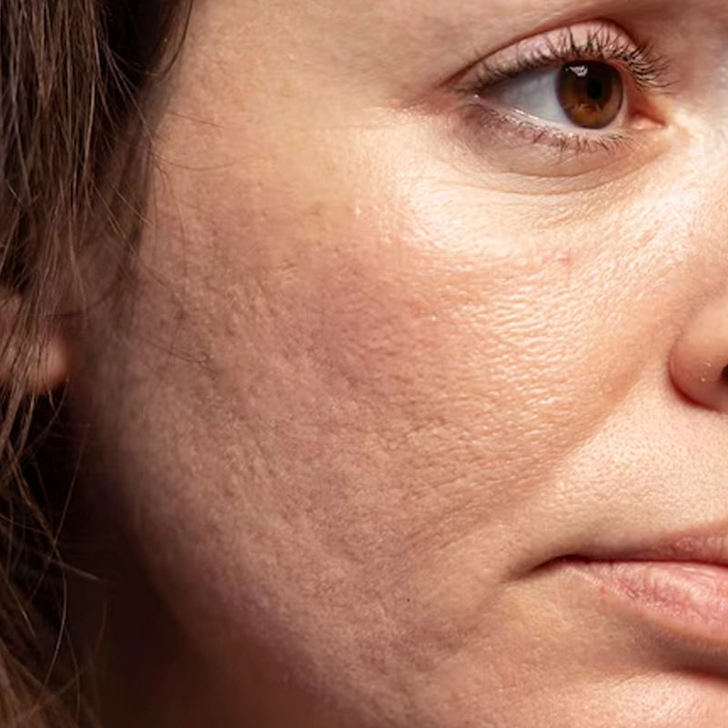 Rutina para la hidratación de la piel