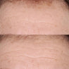 Resultados antes y después del uso de suero para piel sensible Perricone MD Hypoallergenic Smoothing Restorative Serum