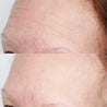 Antes y después del uso de la mascarilla High Potency Hyaluronic Intensive Hydrating Mask de Perricone MD 