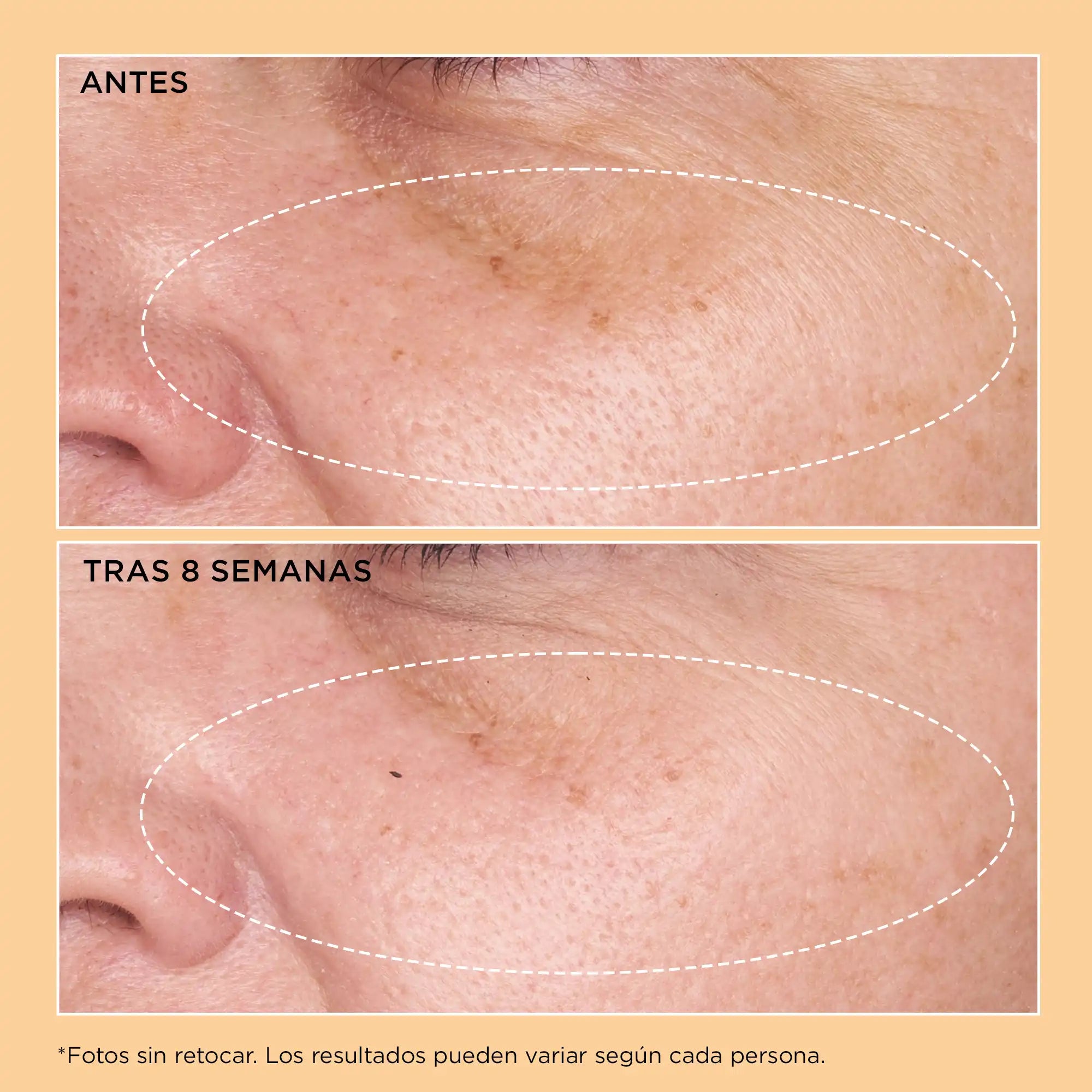 Mejora visible de arrugas profundas y firmeza tras 8 semanas de uso del Neuropeptide Rejuvenating Moisturizer SPF 25.