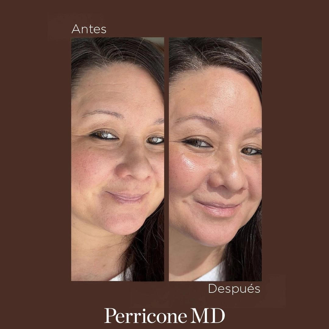 La cara de una mujer antes y después de la aplicación de Face Finishing Firming Tinted Moisturizer. Se nota un tono más igualado, uniforme y más luminosidad en la piel.