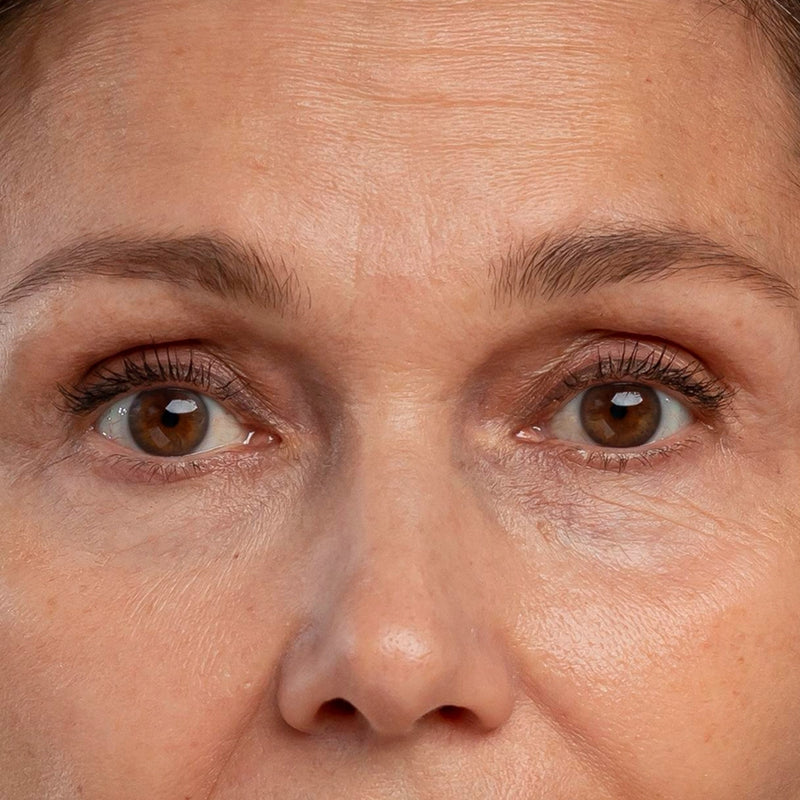 Rutina para las ojeras